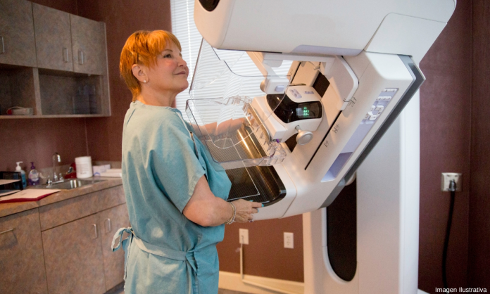 Expertos recomienda hacer mamografías a partir de los 40 años