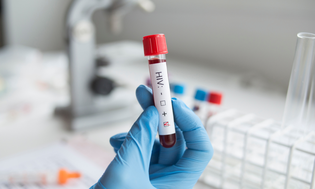 Estados Unidos aprueba tratamiento para prevenir el VIH