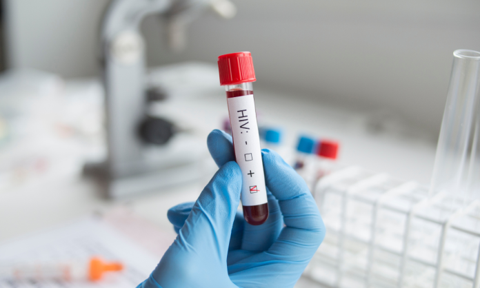 Estados Unidos aprueba tratamiento para prevenir el VIH