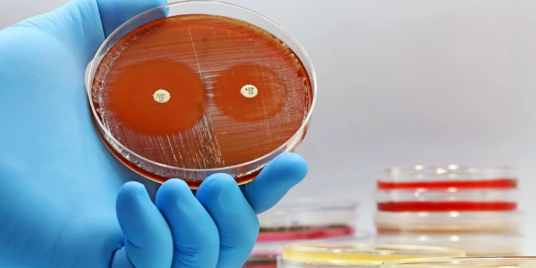 La IA abre nuevas posibilidades contra la resistencia bacteriana